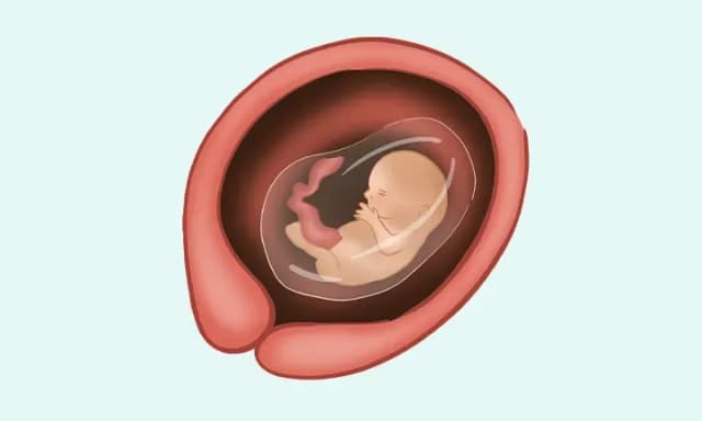 Jak wygląda płód w 13 tygodniu ciąży? Zaskakujące zmiany i rozwój Jak wygląda płód w 13 tygodniu ciąży? Zaskakujące zmiany i rozwój