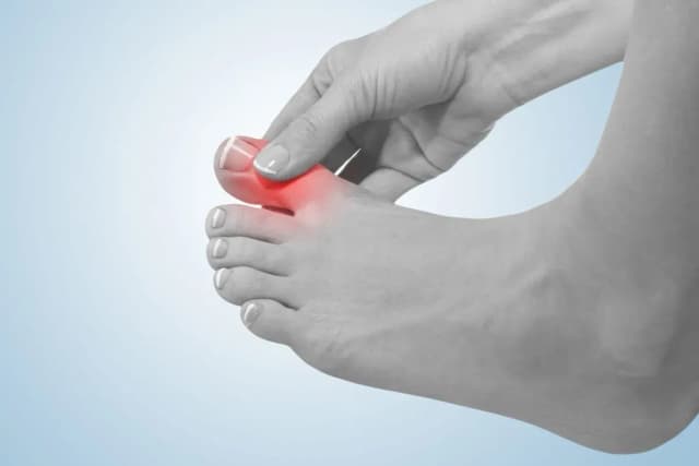 Jakie badania na dnę moczanową? Kluczowe testy, które musisz znać Jakie badania na dnę moczanową? Kluczowe testy, które musisz znać