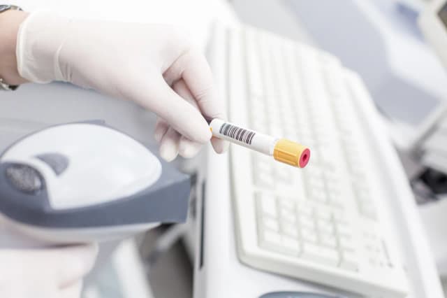 Cukrzyca jakie badania? Kluczowe testy, które musisz znać Cukrzyca jakie badania? Kluczowe testy, które musisz znać