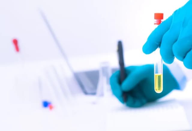 Ile ml moczu potrzebne do badania? Kluczowe informacje i wskazówki Ile ml moczu potrzebne do badania? Kluczowe informacje i wskazówki