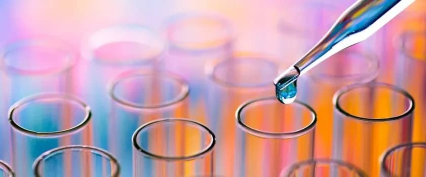 Kwas moczowy badanie z krwi czy z moczu - co wybrać i dlaczego? Kwas moczowy badanie z krwi czy z moczu - co wybrać i dlaczego?