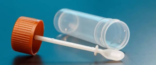 Ile kosztuje badanie na pasożyty? Ceny w miastach Polski i porady Ile kosztuje badanie na pasożyty? Ceny w miastach Polski i porady