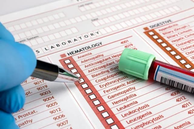 Jakie badanie krwi wykryje raka? Kluczowe testy i ich znaczenie Jakie badanie krwi wykryje raka? Kluczowe testy i ich znaczenie